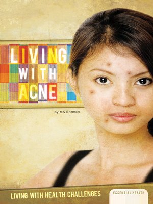 cover image of Living with Acne